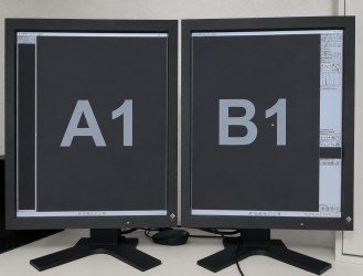 Digitaler Röntgenbildbetrachter